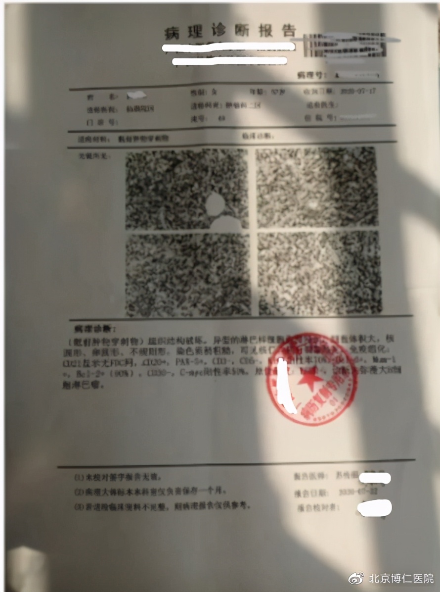 确诊淋巴瘤的最可靠依据是什么,淋巴瘤预后差有治疗必要吗