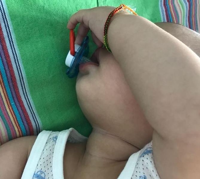 宝宝牙龈变形突出怎么恢复,宝宝上牙床凹凸不平怎么办