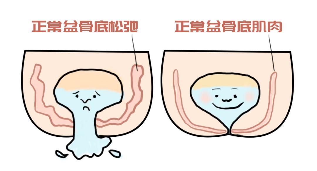 每个仙女都需要关注盆底的健康