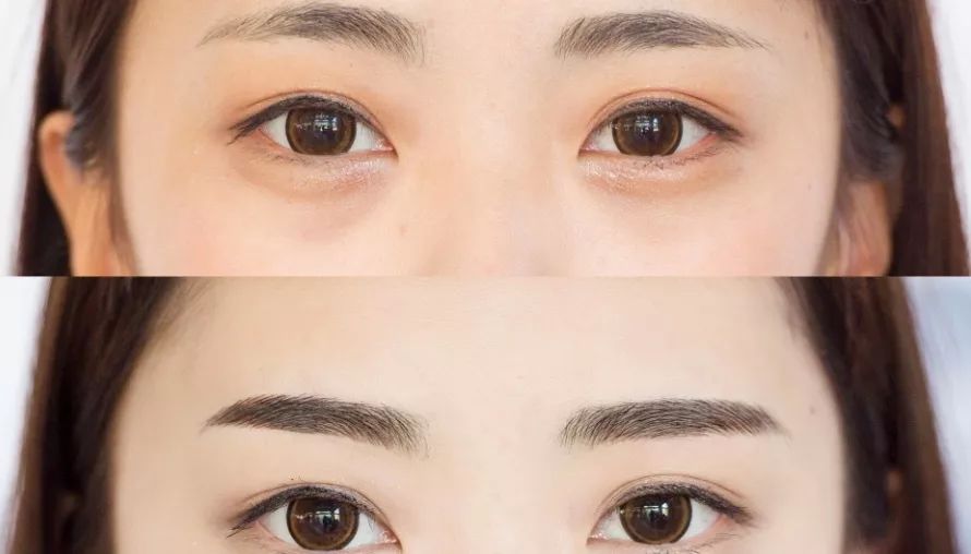 半永久纹眉两年后是什么样的,半永久纹眉最新技术5年