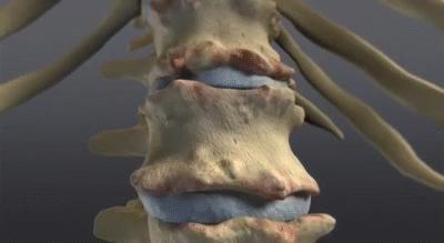 五种疾病别再被江湖郎中忽悠了,忽悠我们多年的5种疾病