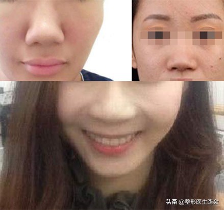 你的鼻子是怎样的,你的鼻子是什么的形状