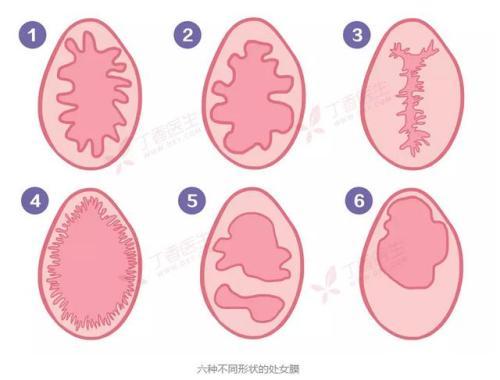 原来清朝时期女子出嫁前需要检查这身体