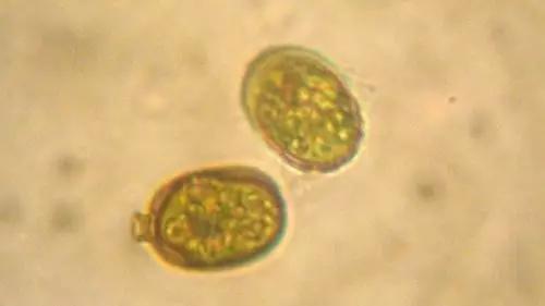 水产养殖藻类老化是怎样的,水产养殖显微镜下各种藻类