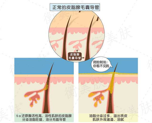 丽皙白护肤品怎么样,丽皙白精华