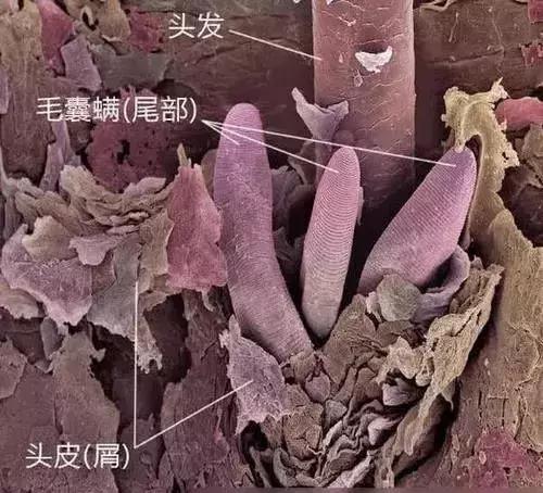 螨虫辟谣大全,你知道螨虫的危害吗涨知识