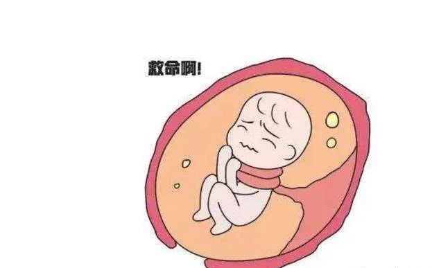 35周脐带绕颈一周,孕期脐带绕颈怎么办