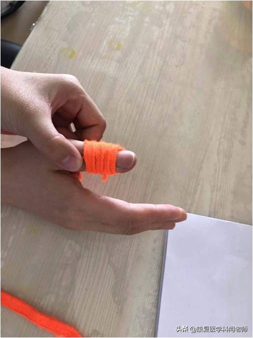 脑卒中后偏瘫患者常见并发症:肩手综合征的康复治疗