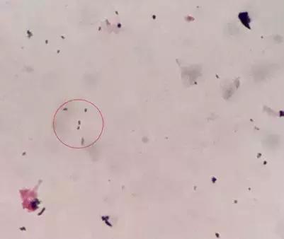 细菌感染血液检查结果,布鲁氏杆菌感染抽血检验