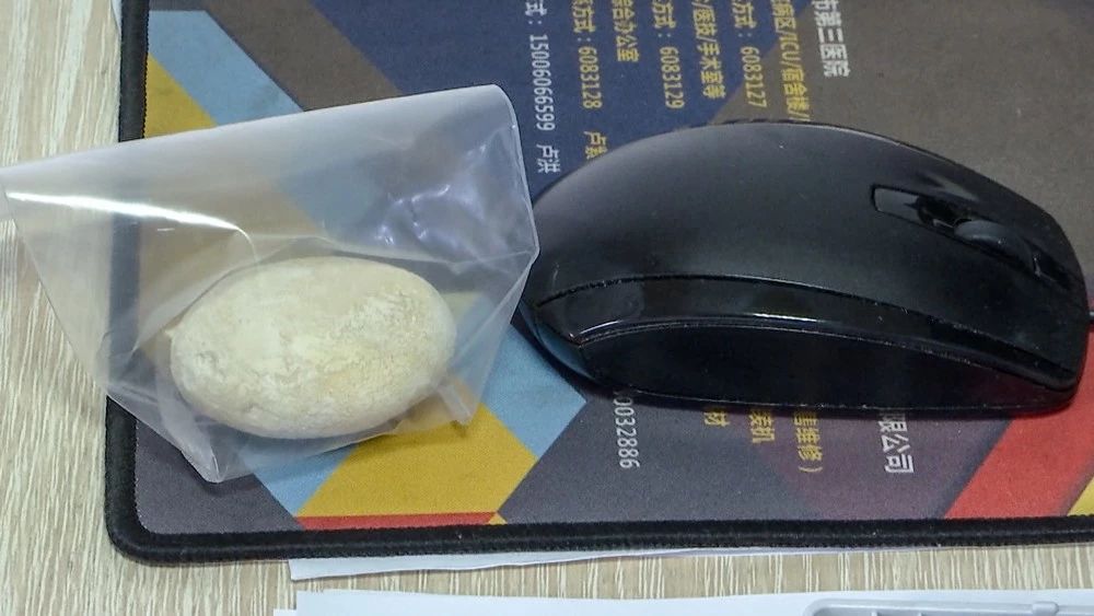 龙文:夏季结石高发,三院医生教你如何预防!