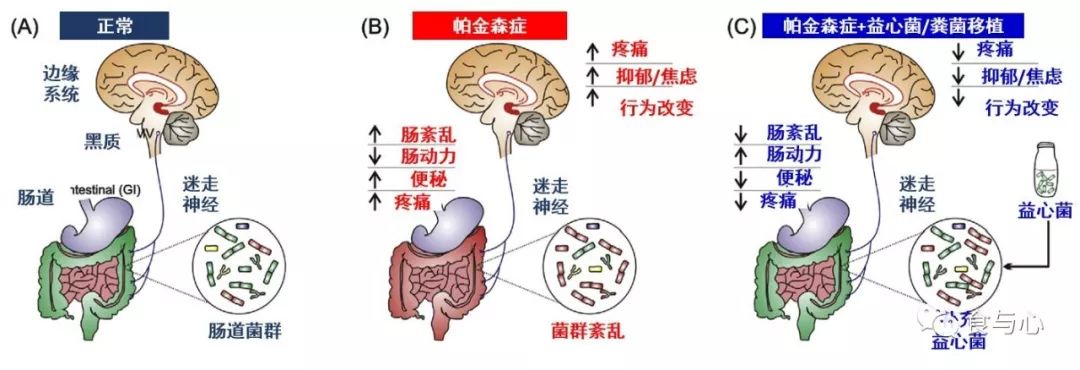 肠漏症的三大指标,肠漏症和脑漏症