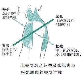 肌肉的形态是天生就已经决定的了,肌肉形态不对称
