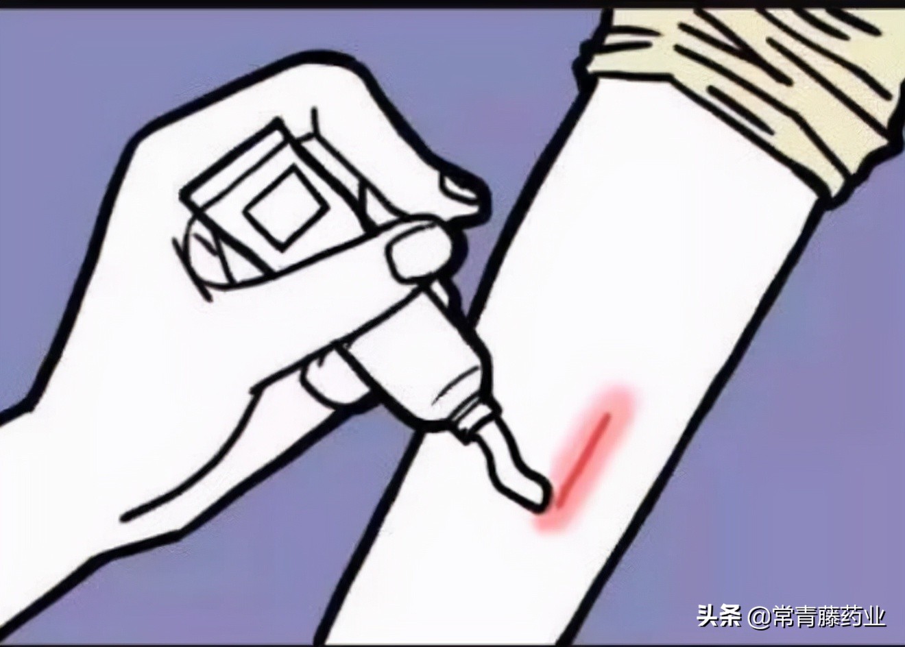 爱美之心，人皆有之，瘢痕的这些事是你想要知道的吗？