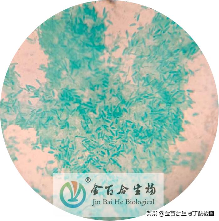 革兰氏染色显微镜下的图手绘,革兰染色用的显微镜是什么