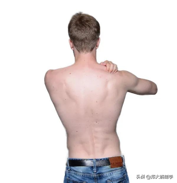 冈上肌肌腱断裂能抬肩吗,抬肩困难