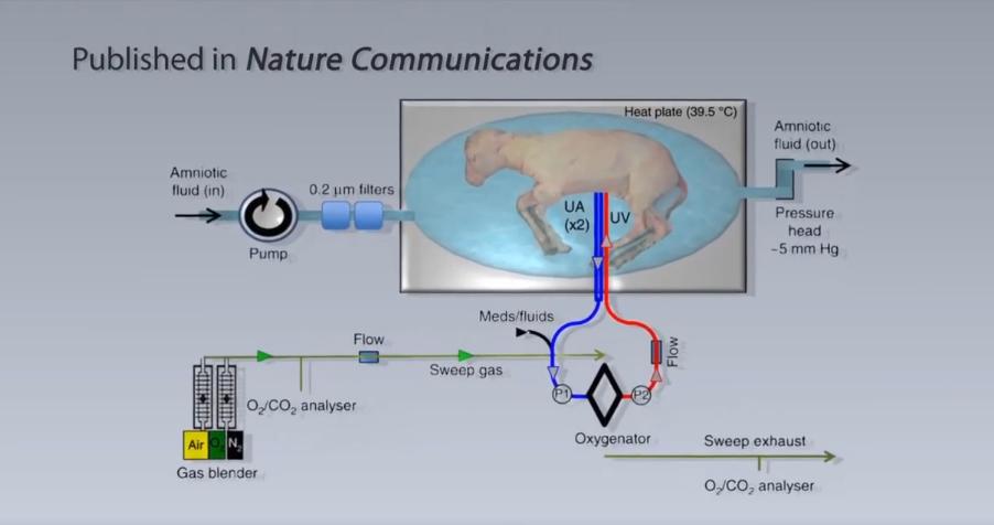 人造子宫实现让人类复活,人类能接受人造子宫吗