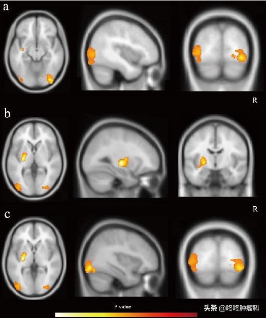 服用靶向药会不会刺激肿瘤生长,服用靶向药还会复发吗