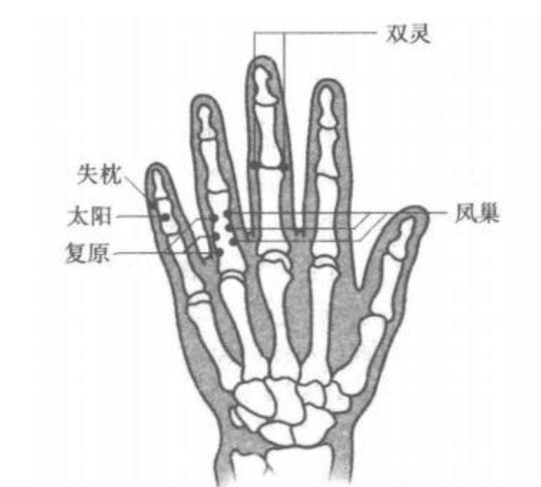 耳朵经常嗡嗡响可以中医针灸吗,耳朵乳突炎能针灸治疗治愈吗