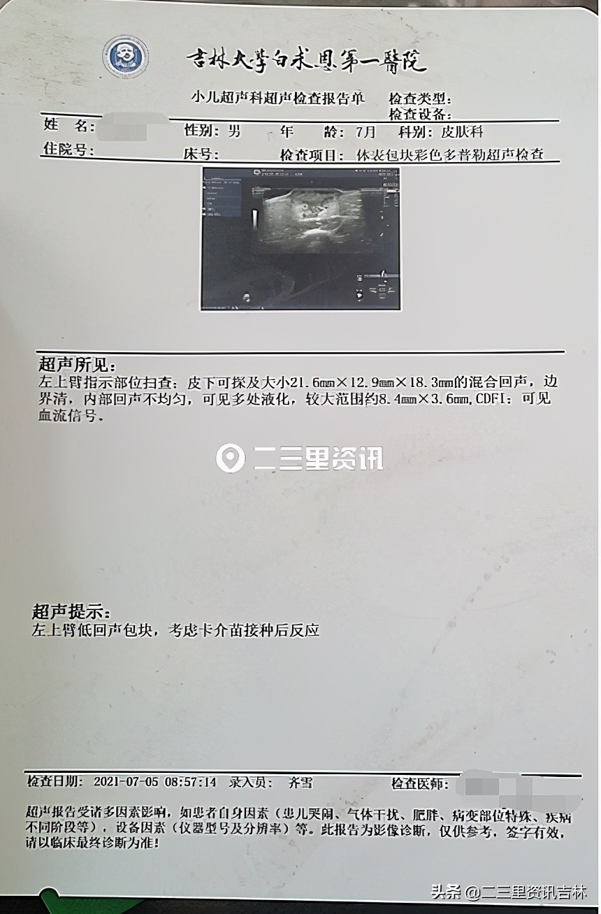 小孩接种卡介苗很久红肿,宝宝接种卡介苗后红肿化脓