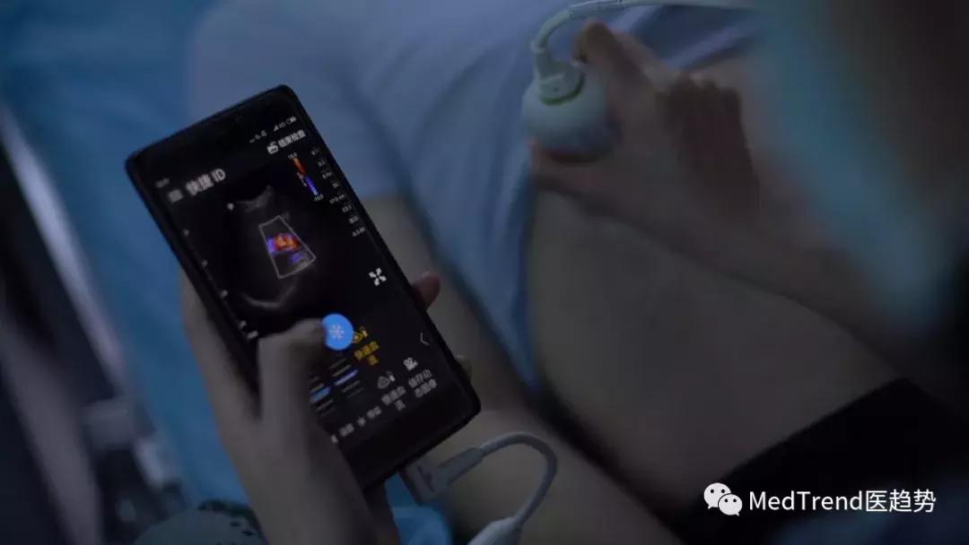 飞利浦超声探头l15-7,飞利浦超声仪器测评