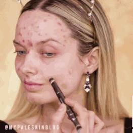 吃火锅冒痘怎么办,吃辣火锅爆痘怎么办