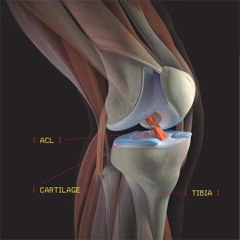 跑步时膝内扣怎么办？痛了就晚了！科学的解决方案在这里