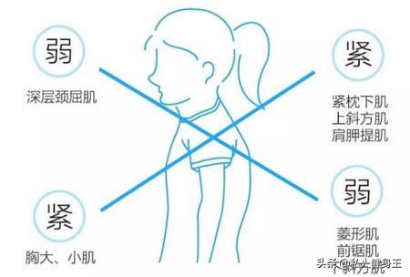 矫正圆肩的6大经典动作,圆肩驼背胸椎高怎么矫正