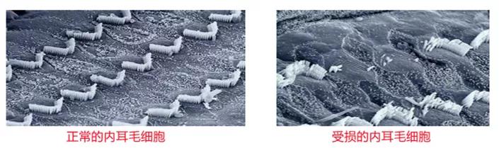 恐声症听到声音后怎么缓解,恐声症是什么原因造成的