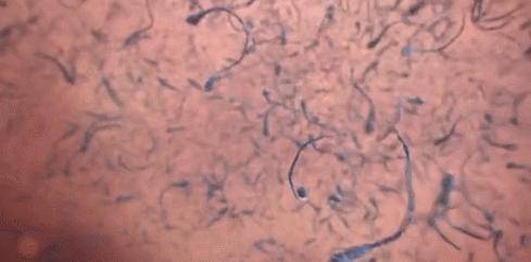 妈妈讲精子和卵子的结合,精子与卵子结合过程科教片