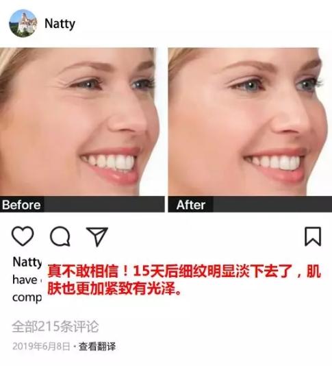 赵露思推荐好物清洁面部,赵露思推荐脸部小熨斗