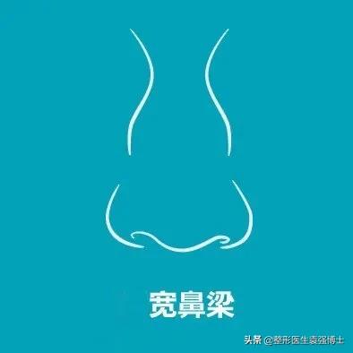 鼻整形如何一步到位,袁博整形医生