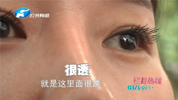 郑州康伦医院整形视频,郑州康伦整形失败案例