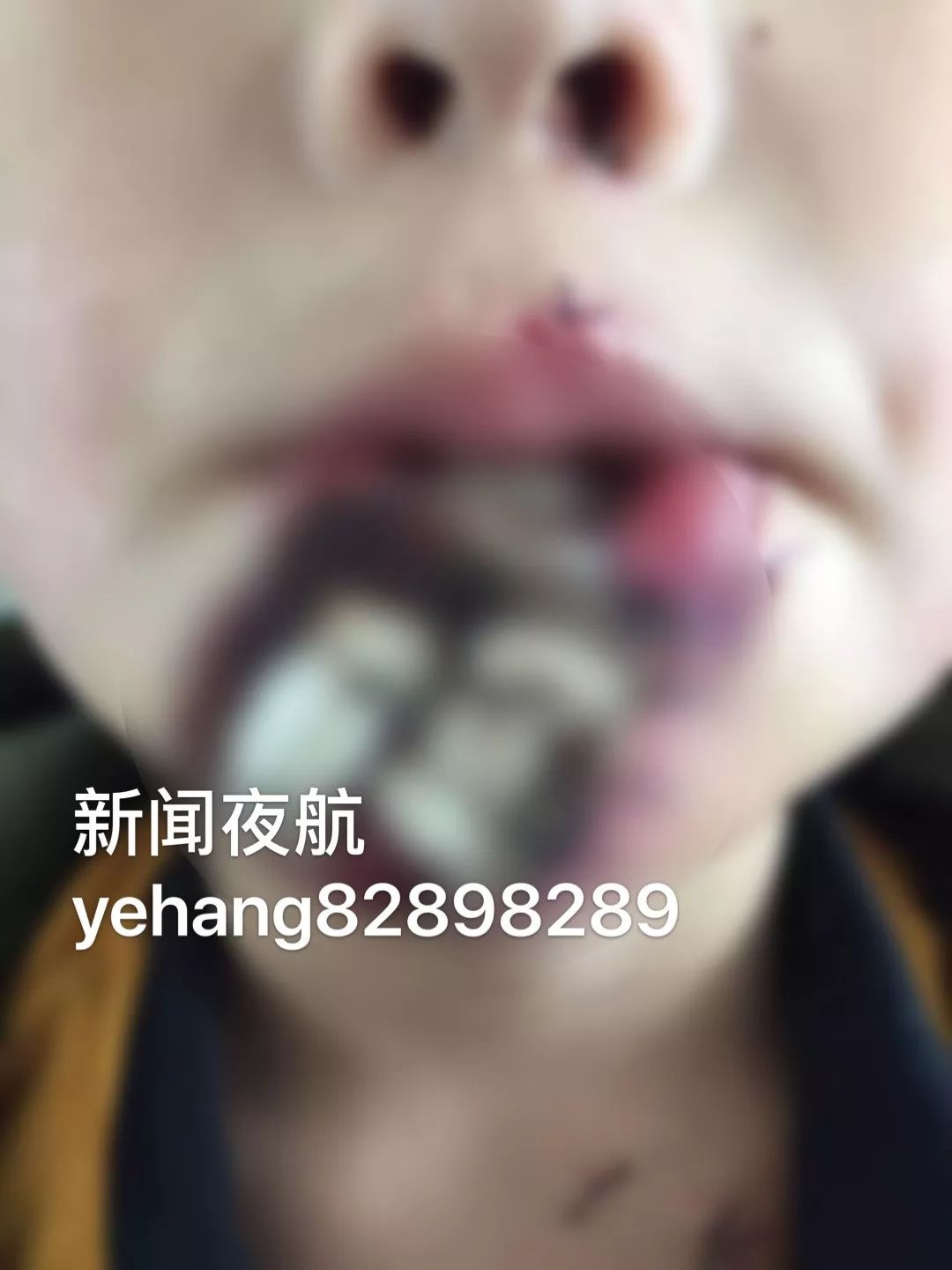 一小孩模仿吃鸡游戏被摔死,男童模仿吃鸡游戏佩戴头盔摔倒