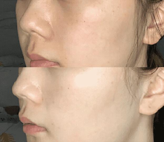 网红推荐的美白精华,网红精华液美白