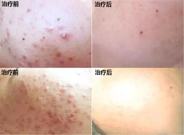 香港明星代言补水去黄提亮面膜,各路明星推荐的面膜怎么样