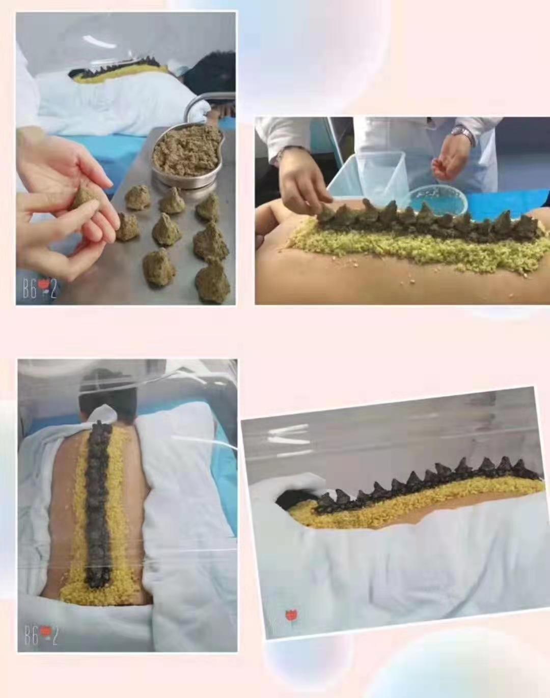 铜川市人民医院最新消息,铜川市人民医院北院区中医科