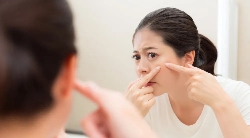 痘庄科学祛痘痘。痘痘反反复复，到底应该怎么办？