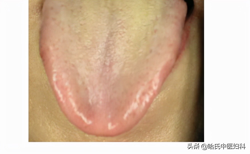 卵泡长不大萎缩怎么备孕,卵泡长不大怎么锻炼身体