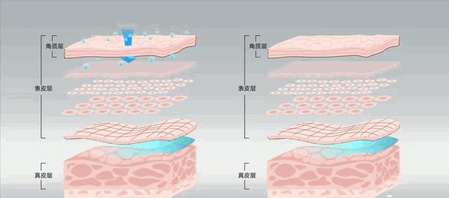 杨紫近照曝光无修图法令纹很深,杨紫面部填充法令纹