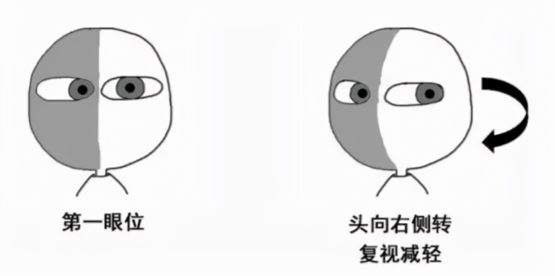 写字防歪头姿势纠正神器,儿童歪头最好的纠正法