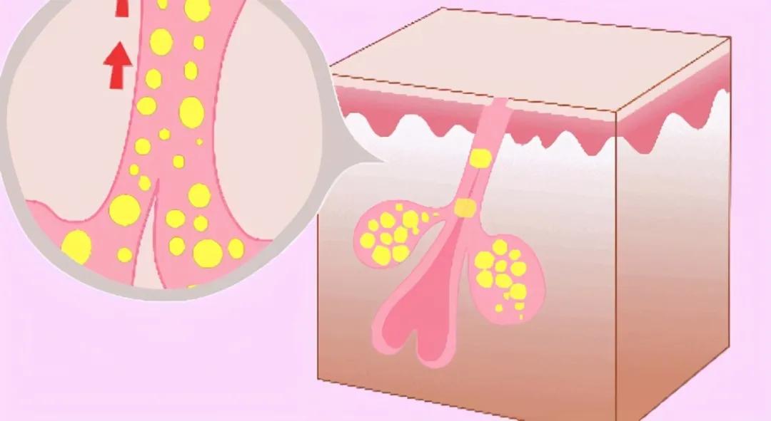 油皮控油的最好方法,混油皮夏季控油保湿