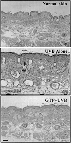 如何防止光老化氧化,预防光老化的最佳方法