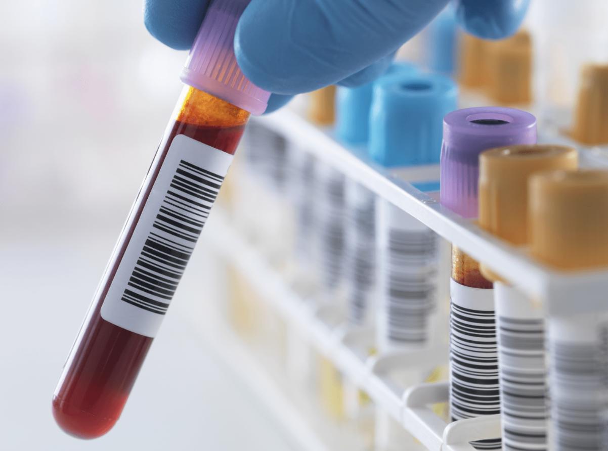 空谈技术优势,监管和价格依然是和瑞基因无法逃脱的两座高山