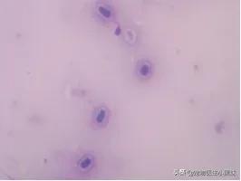 科学养宠攻略猫癣,宠物猫藓如何治疗好的视频