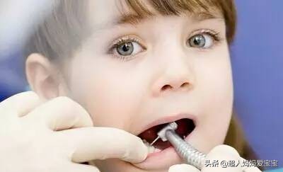 小孩的乳牙蛀牙了有必要补吗,孩子乳牙蛀牙有什么补救方法