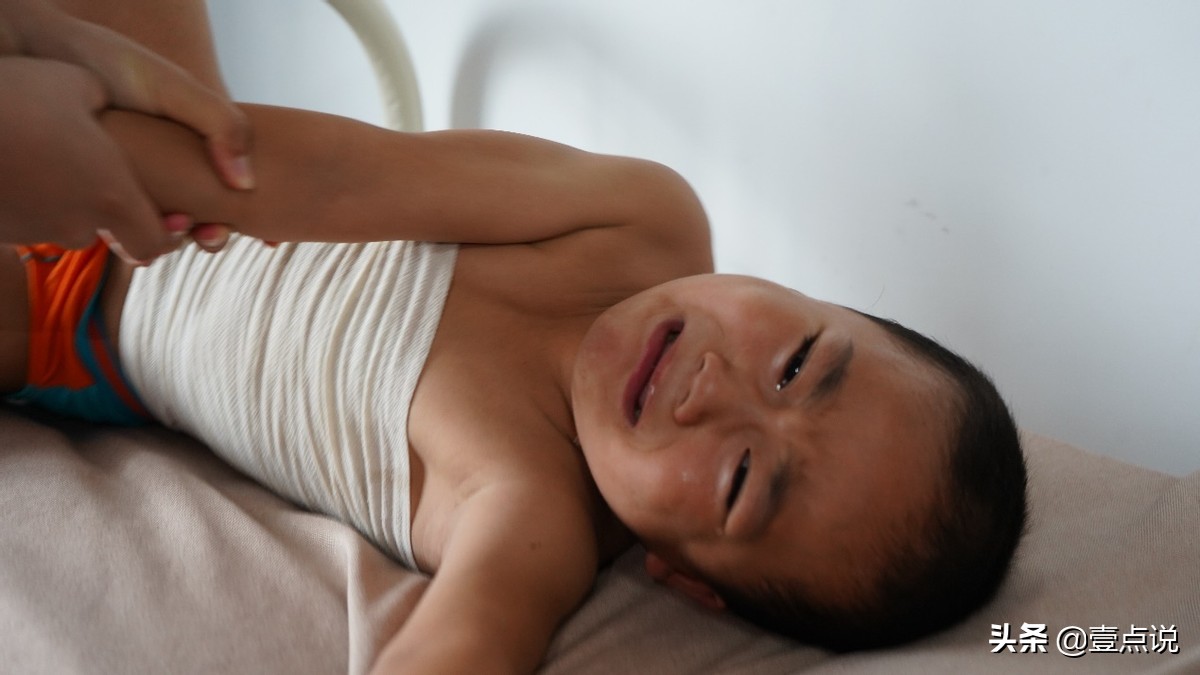 意外毁容真实案例,因为一次意外毁了女孩的一生