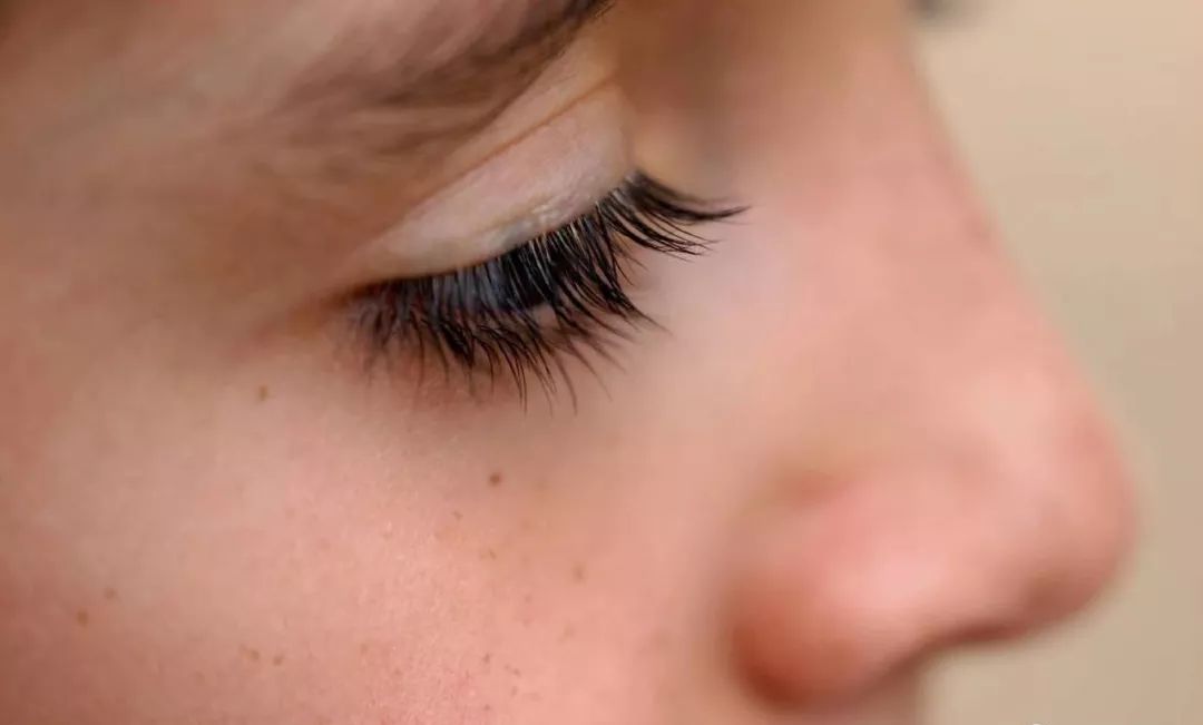 不同人群长斑原因与祛斑方法,长斑的原因你了解吗