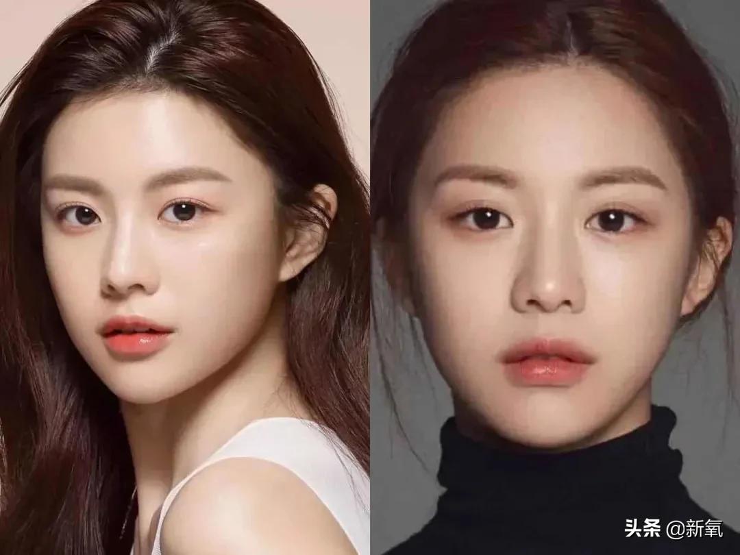 脸松弛下垂做哪种整形,面部下垂整形方法