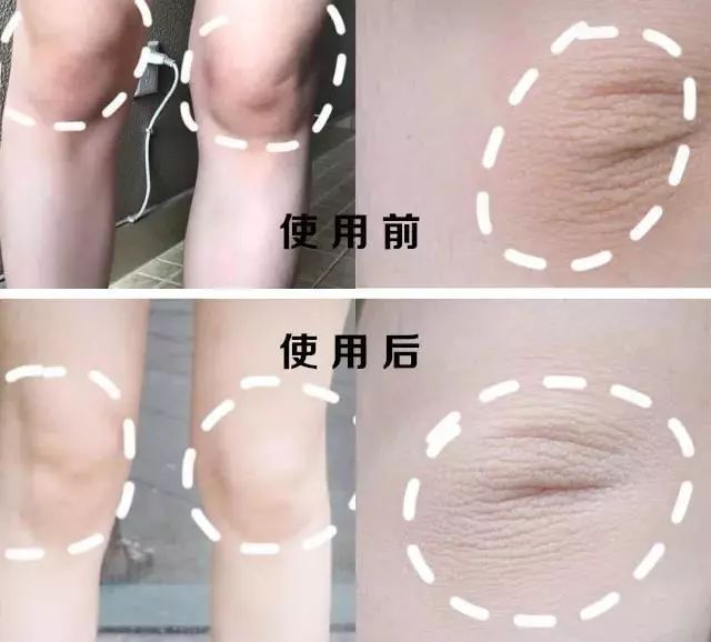 夏天肤色黑怎么办,黑黄暗沉肤色改善