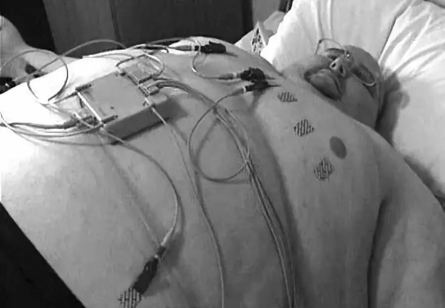 减脂期如何预防皮肤松弛,减肥期间怎样能不让脸部皮肤松弛